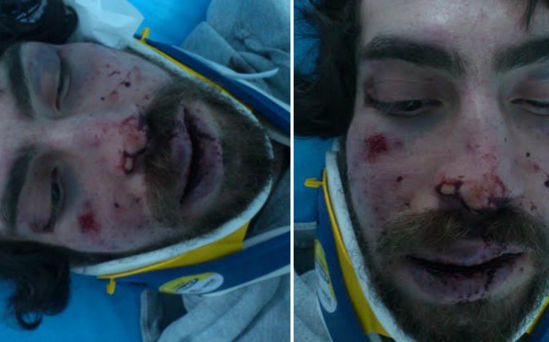 Απολογείται σήμερα ο 42χρονος που ξυλοκόπησε το φοιτητή