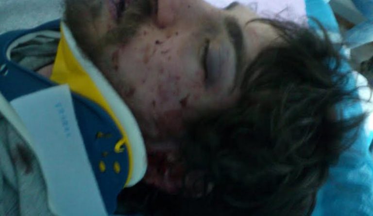 Συνέλαβαν 42χρονο Χρυσαυγίτη για τον άγριο ξυλοδαρμό του φοιτητή