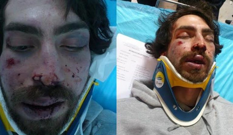 Τυφλά αντίποινα από τη Χρυσή Αυγή – Τον έδειραν για ένα… σακίδιο