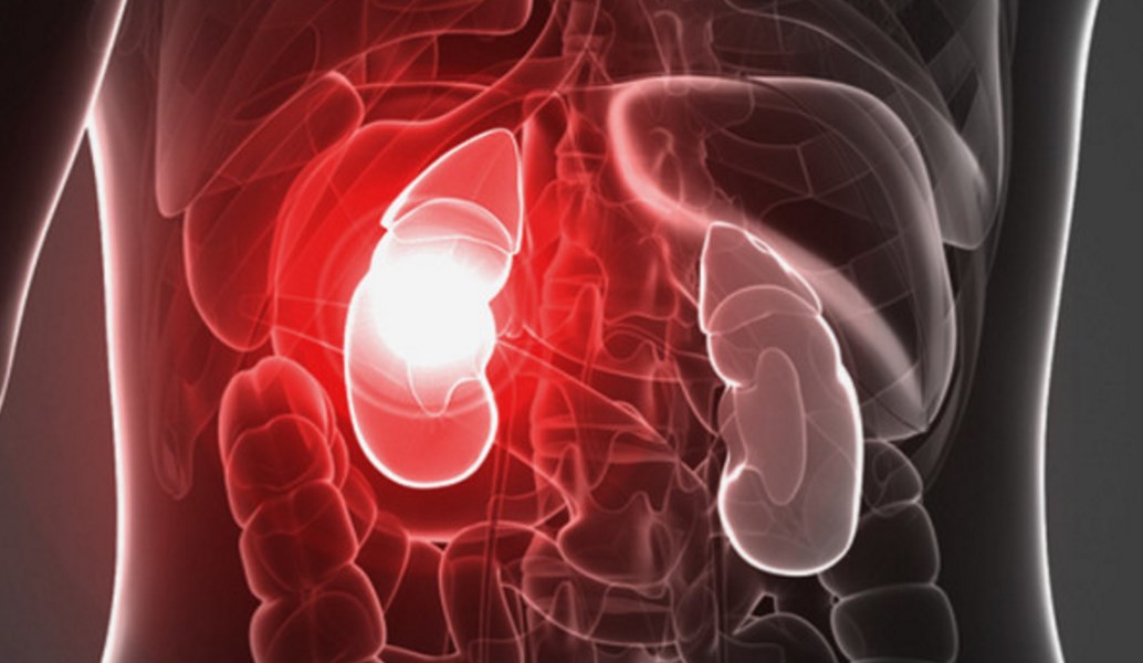 Αιμοκάθαρση: Η γυμναστική μειώνει τη θνησιμότητα των ασθενών με νεφρική ανεπάρκεια