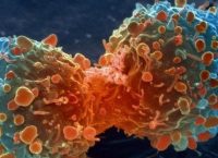 Καρκίνος του μαστού: “Επαναστατικό” τεστ βάζει τέλος στις χημειοθεραπείες