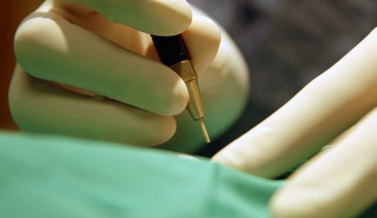 Περισσότερα κρούσματα καρκίνου στην Ευρώπη, λιγότεροι θάνατοι