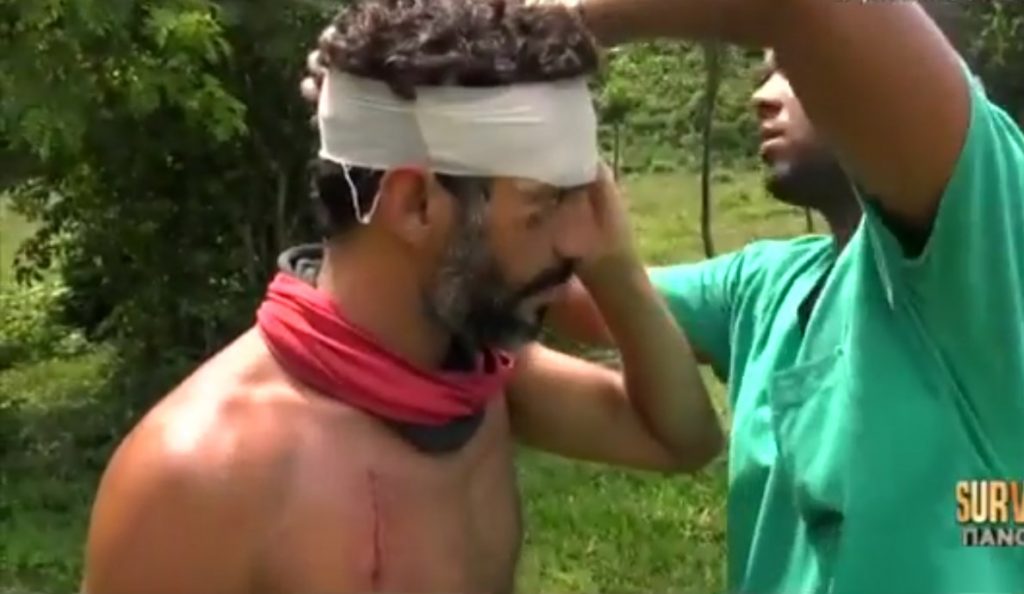 Survivor: Τραυματίστηκε στο κεφάλι ο Χρανιώτης – Δείτε πλάνα (vid)