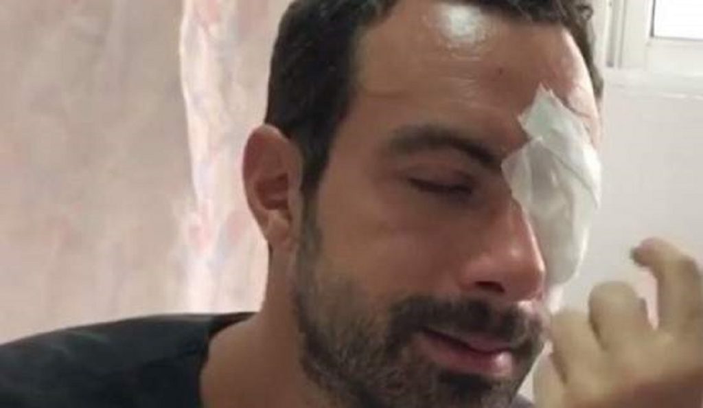 Σάκης Τανιμανίδης: Αγνώριστος και χωρίς μούσια στα φοιτητικά του χρόνια (pic)