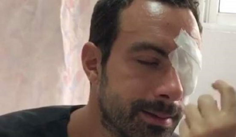 Σάκης Τανιμανίδης: Αγνώριστος και χωρίς μούσια στα φοιτητικά του χρόνια (pic)