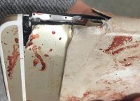 Γυναίκα στο Μάντσεστερ σώθηκε απ’ το τρομοκρατικό χτύπημα λόγω του κινητού της (pics)