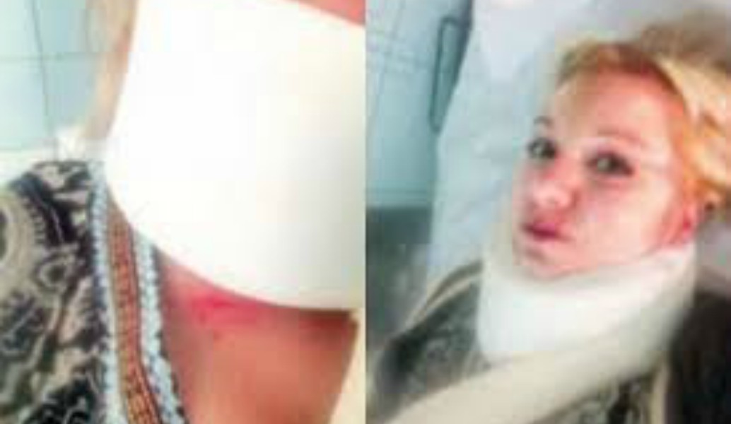 Συγκλονίζει η φοιτήτρια που έπεσε θύμα άγριου ξυλοδαρμού μέσα στο Δημοκρίτειο Πανεπιστήμιο