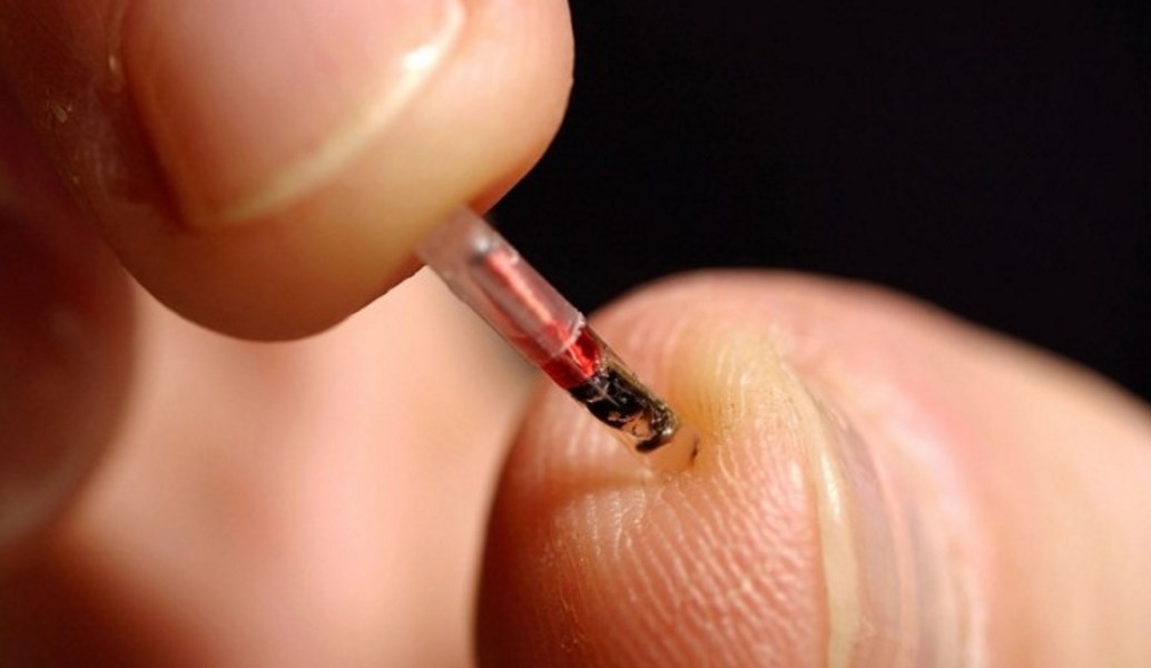 ΗΠΑ: Εμφύτευση μικροτσίπ σε εργαζομένους εταιρείας