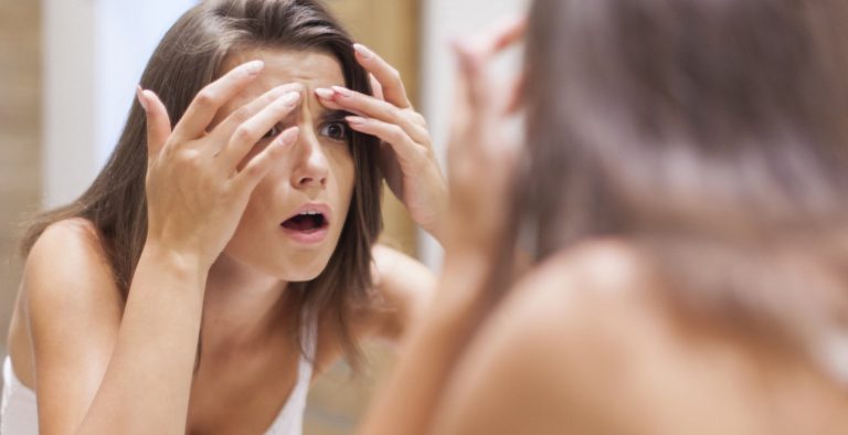 Πώς να εξολοθρεύσετε τα σπυράκια με φυσικά υλικά