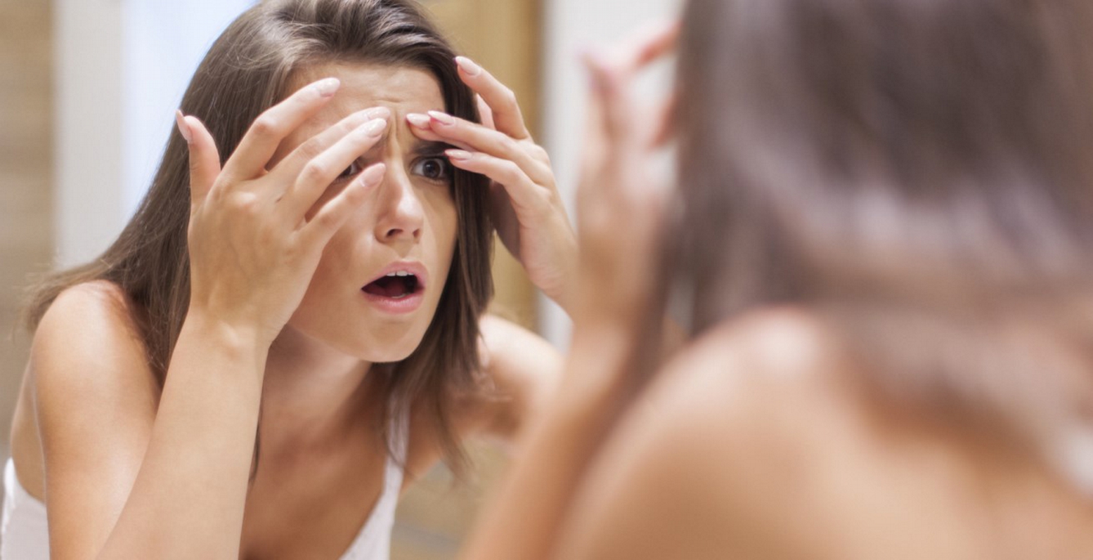 Πώς να εξολοθρεύσετε τα σπυράκια με φυσικά υλικά