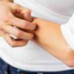 Φαγούρα: Οι 3 λύσεις για άμεση ανακούφιση