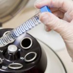 Γονιμότητα: Σύμμαχός της η κρυοσυντήρηση ωαρίων και σπερματοζωαρίων