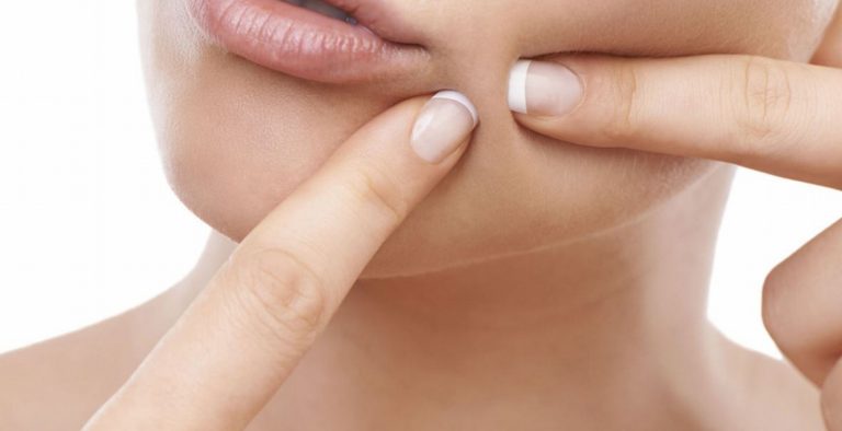 Δέρμα με ακμή; Το ρούμι θα κάνει τη διαφορά!