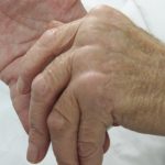 BiP: Ανθρώπινη πρωτεΐνη για τη θεραπεία της ρευματοειδούς αρθρίτιδας