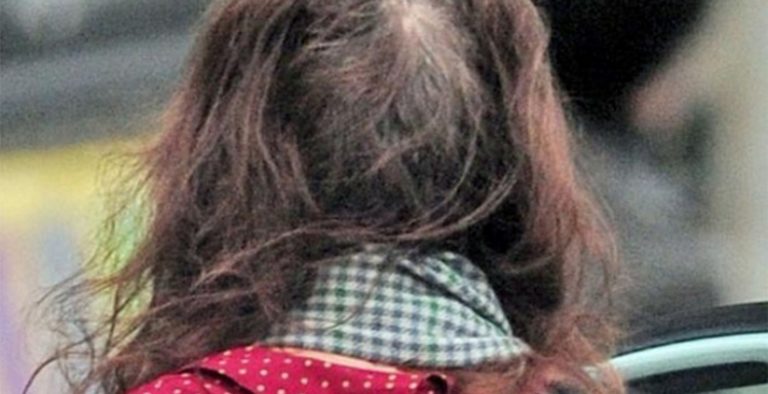 Σοκάρει η σημερινή εικόνα πασίγνωστης ηθοποιού