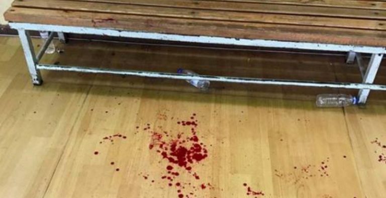 Απίστευτο σκηνικό σε ελληνικό γήπεδο: Χτύπησαν προπονητή με σιδερογροθιά εν ώρα αγώνα !
