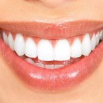 Αστραφτερό χαμόγελο με απόλυτα φυσικό τρόπο