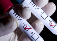 AIDS: Για δεύτερη φορά στον κόσμο ασθενής φαίνεται να θεραπεύθηκε από το ιό