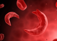 Γεγονός η πρώτη επιτυχής θεραπεία δρεπανοκυτταρικής αναιμίας