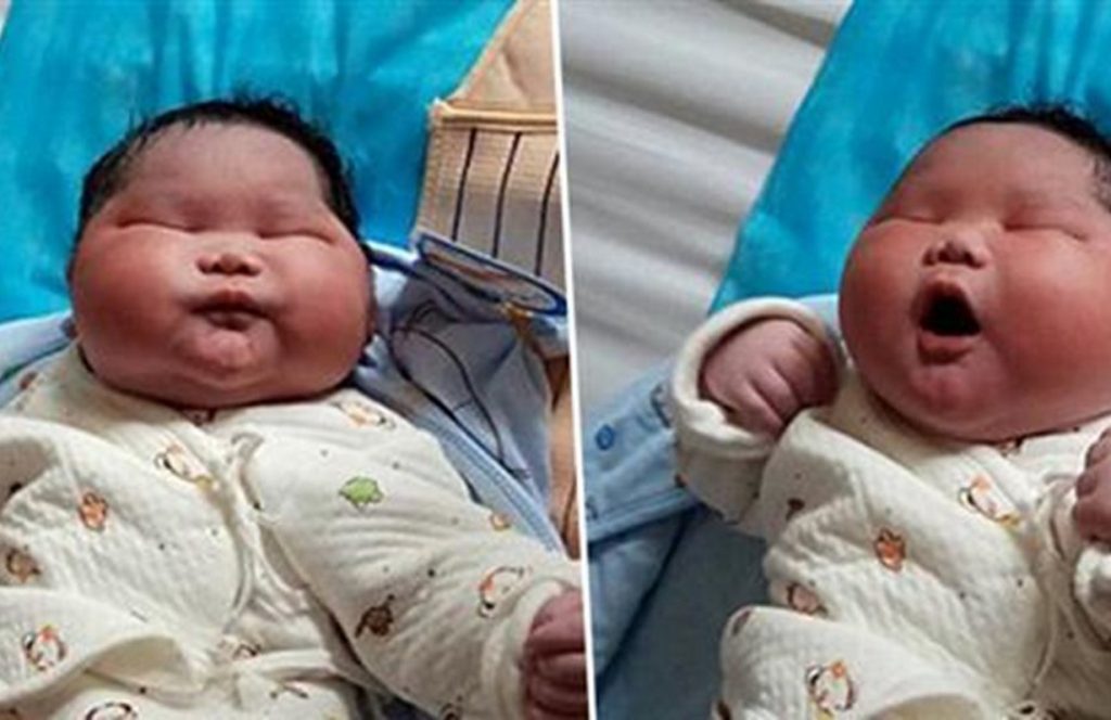 Viral: Παιδί στην Κίνα γεννήθηκε 7 κιλά. Οι φωτογραφίες που κάνουν τον γύρο του κόσμου