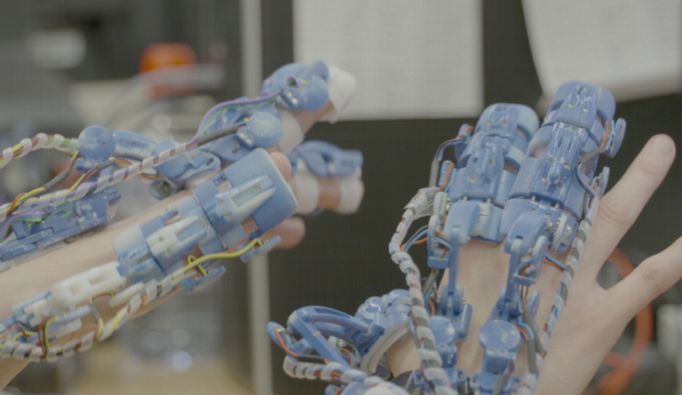 Εξωσκελετικό ρομποτικό υποβοήθημα για χειρουργικές επεμβάσεις