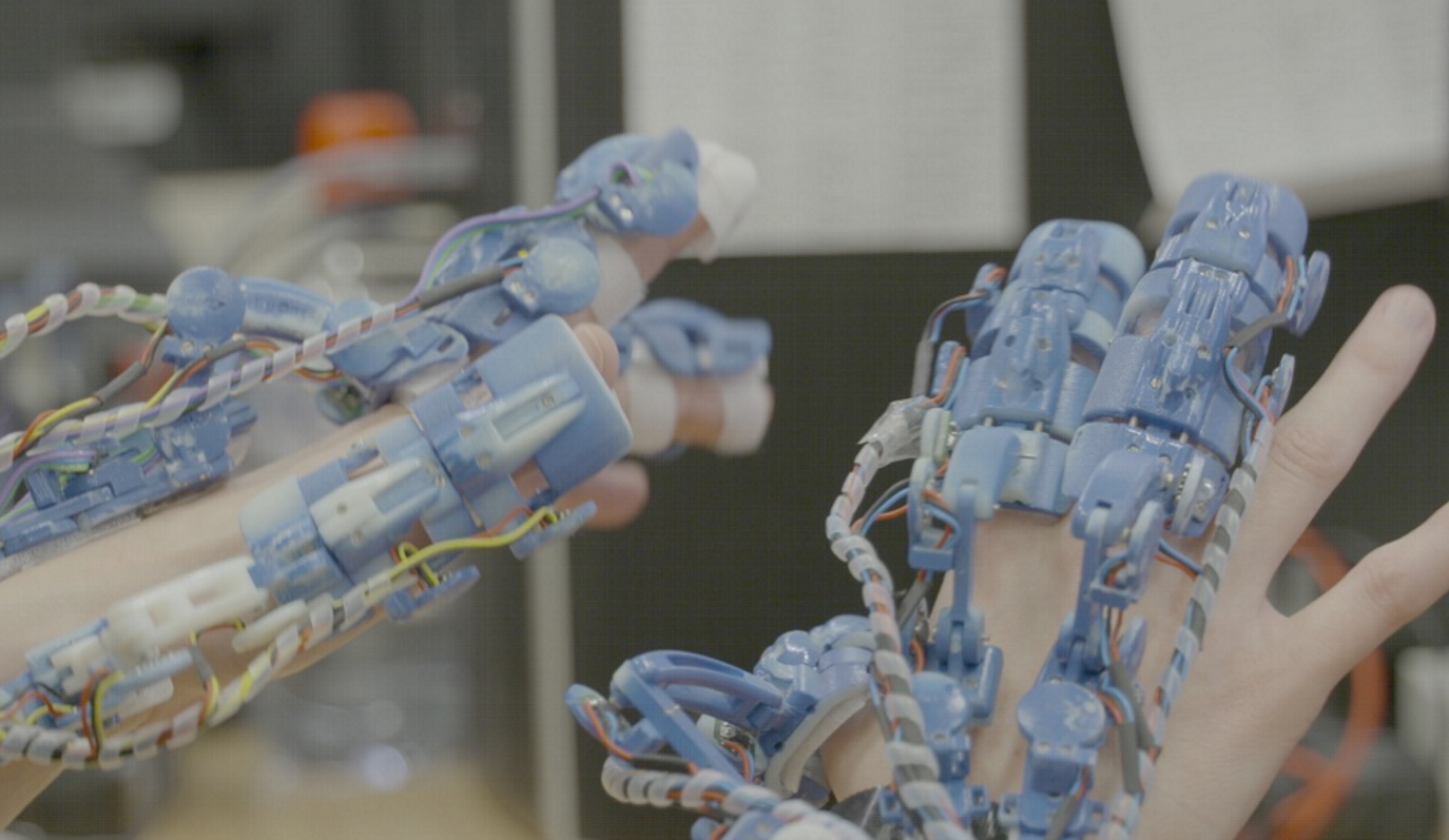 Εξωσκελετικό ρομποτικό υποβοήθημα για χειρουργικές επεμβάσεις