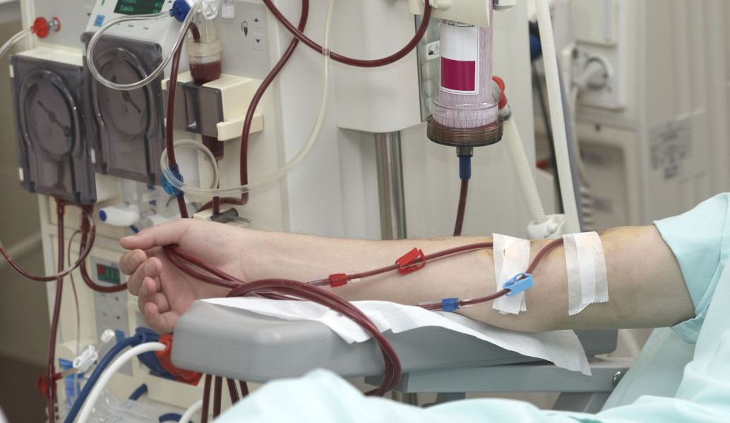 Αιμοκάθαρση: Τι χρειάζεται να γνωρίζεις
