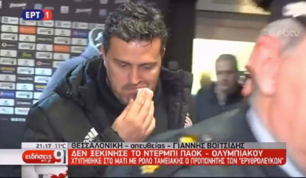 ΒΙΝΤΕΟ: Η αποχώρηση του Γκαρσία απ’ την Τούμπα – Στο στόμα φαίνεται να χτύπησε (vid)