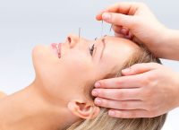 Βελονισμός: Αρωγός για να κόψετε το κάπνισμα