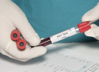 HIV: Μια νέα κάψουλα αργής αποδέσμευσης, μπορεί να απλοποιήσει τη θεραπεία του