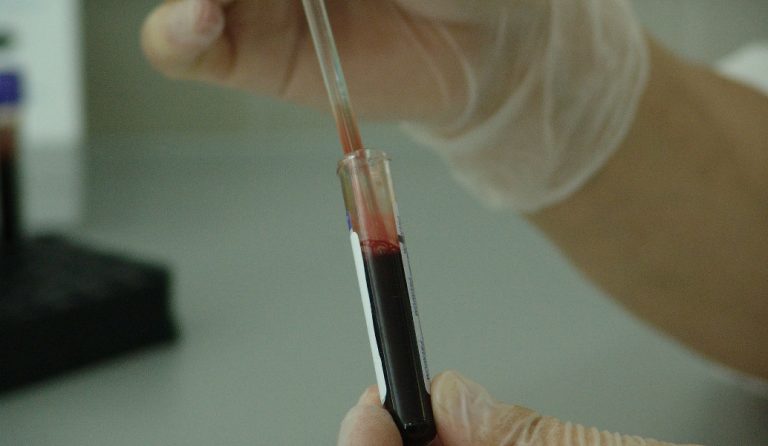 Καρκίνος: Οι 5 βασικές ομάδες της νόσου