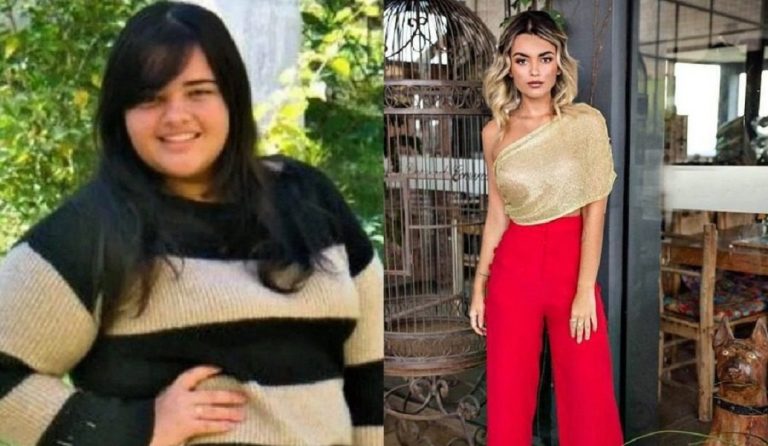 Απίστευτο: Kάποτε ήταν 140 κιλά και τώρα είναι μοντέλο! (pic)