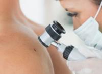 Σημαντική μείωση των θανάτων από μελανώματα μέχρι το 2050