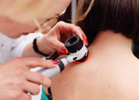 Μελάνωμα: Γιατί το φθινόπωρο είναι η κατάλληλη εποχή για προληπτικό έλεγχο;