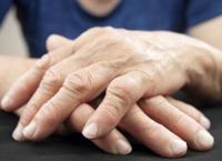 Το σώμα σου μιλάει, άκουσε το! Ενημερωτική εκστρατεία για τις ρευματικές παθήσεις