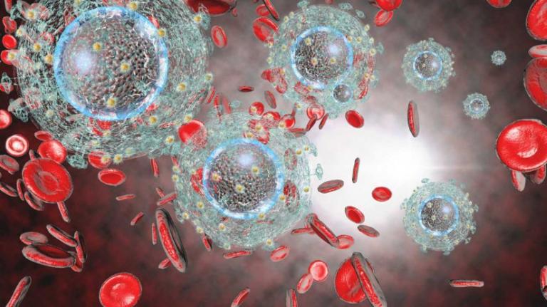 HIV κρούσματα: Αυξήθηκαν στην Ανατολική Ευρώπη και μειώθηκαν στη Δυτική