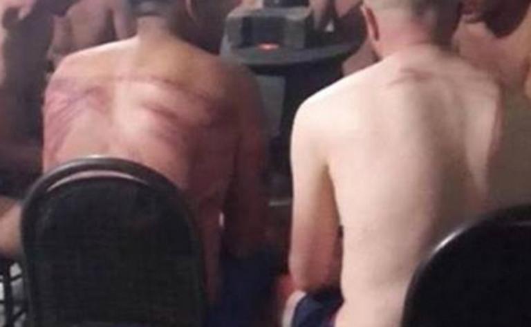 Χαμός με δημοσίευμα στην Τουρκία: “Έλληνες αστυνομικοί βασάνισαν μετανάστες με μπαταρίες” (pic)