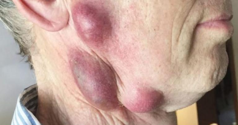 Προσοχή: Δες τι μπορείς να πάθεις αν έχεις γάτα στο σπίτι – Ποια εξέταση πρέπει να της κάνεις άμεσα