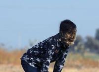 Αγόρι “λυκάνθρωπος”: Η σπάνια ασθένεια από την οποία πάσχει ένα παιδί στην Ινδία (vid)