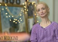 Η γυναίκα “Benjamin Button” – Η απίστευτη ιστορία της (vid)