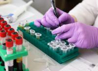 Μεσογειακή αναιμία: Έγκριση της γονιδιακής θεραπείας για την αντιμετώπισή της