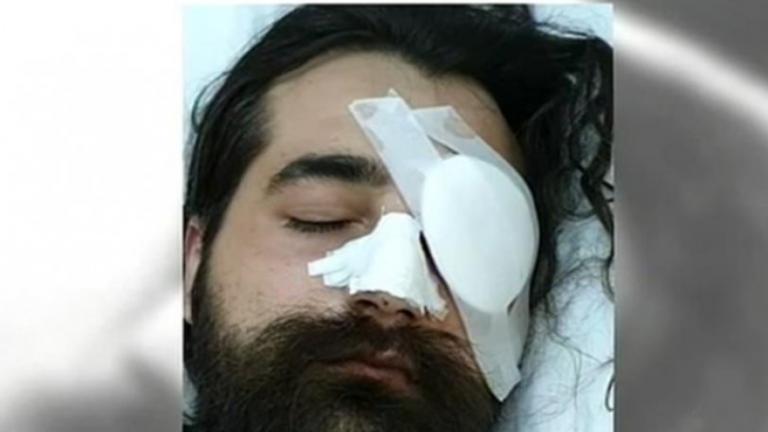 Επεισόδια στο ΟΑΚΑ: Οργή από τον οπαδό που έχασε το μάτι του – “Να βρεθεί ο υπαίτιος”