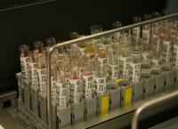 Ουρολοίμωξη: Συμπτώματα και μυστικά για άμεση αντιμετώπιση