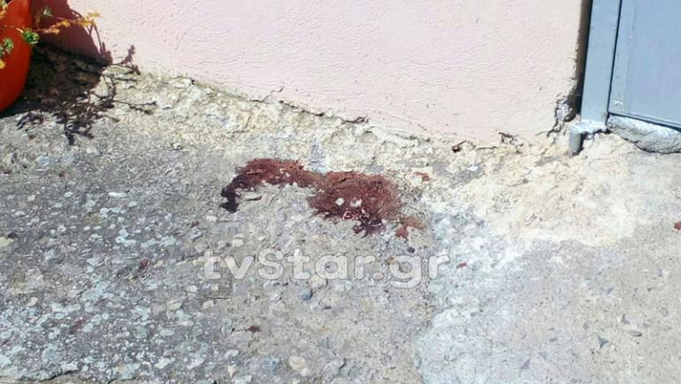 Θήβα: Χαροπαλεύει το 8χρονο κοριτσάκι – Παραμένει στη ΜΕΘ (pics)