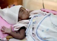 Έρευνα: Ένα στα επτά παιδιά γεννιούνται με λιγότερο βάρος από το κανονικό