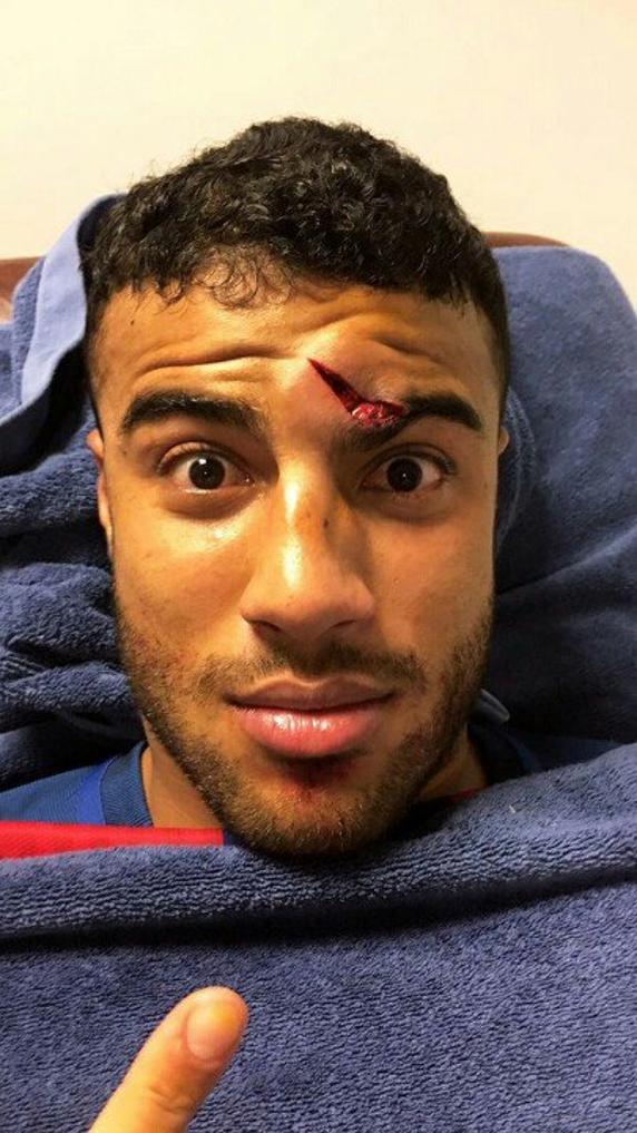 Barcelona star suffers a horrific head injury v Athletic Bilbao