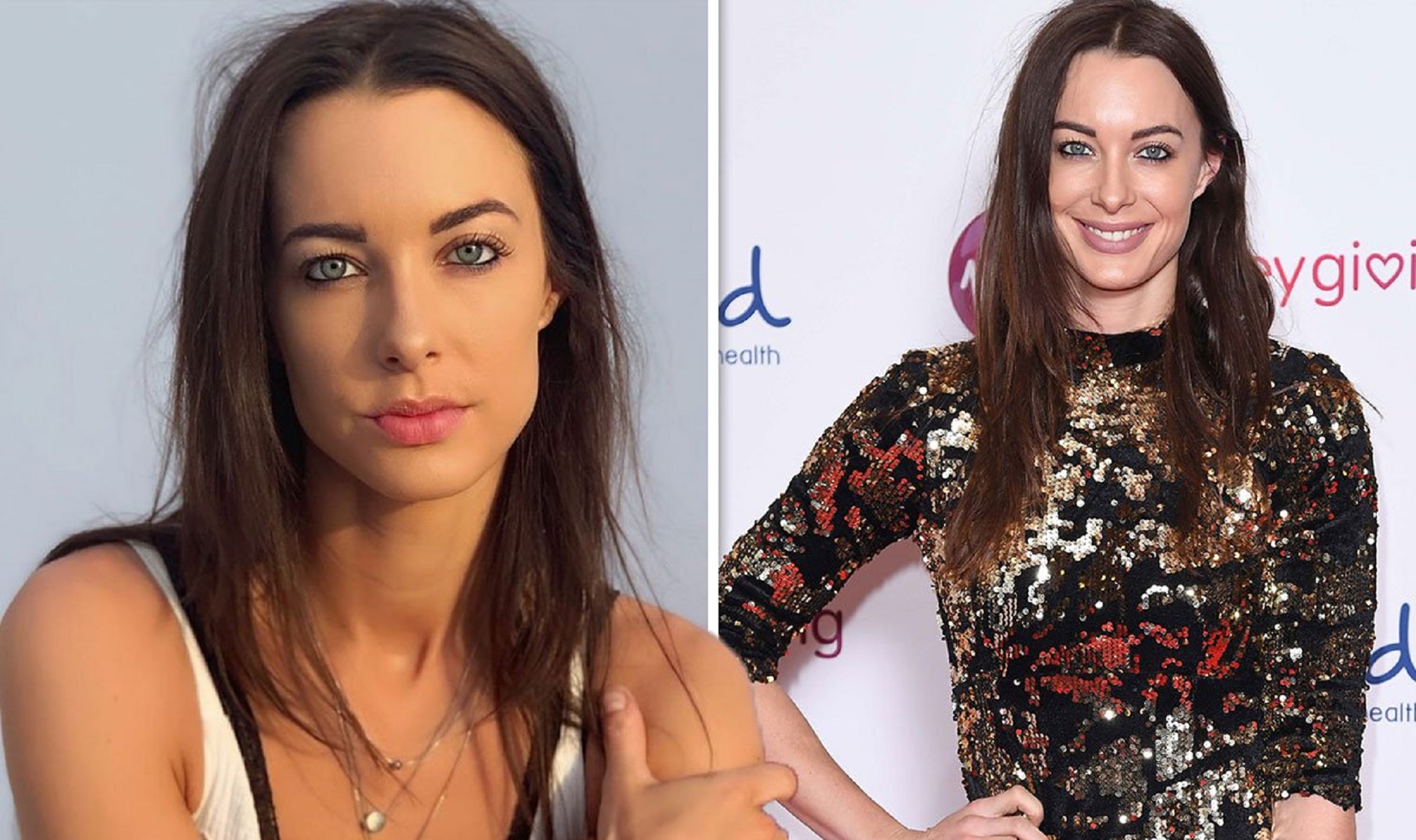 Emily Hartridge: Νεκρή η διάσημη Youtuber μετά από δυστύχημα με ηλεκτρικό πατίνι