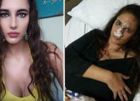 Ναστάζια Μητροπούλου: Aποκάλυψε στο Facebook τον ξυλοδαρμό από τον σύντροφό της (pics)