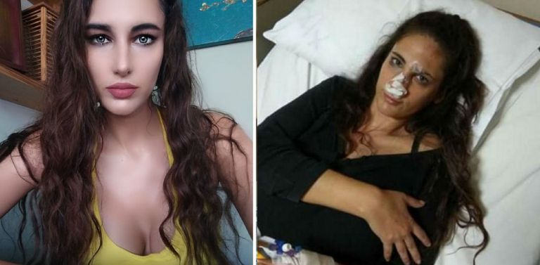 Ναστάζια Μητροπούλου: Aποκάλυψε στο Facebook τον ξυλοδαρμό από τον σύντροφό της (pics)