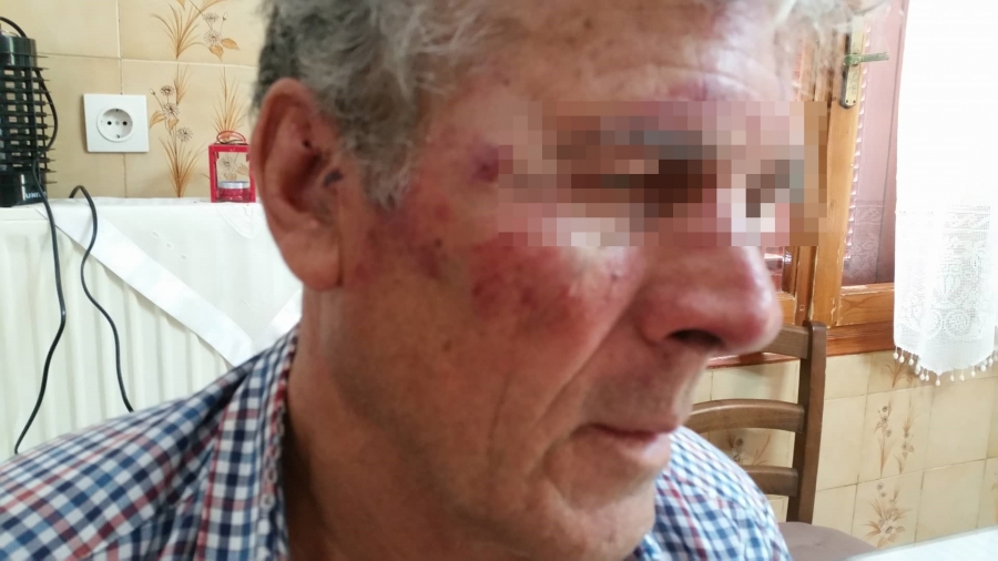 Απίστευτο: Τούρκοι έδειραν 73χρονο Έλληνα στη Σάμο επειδή άκουγε εκκλησιαστική λειτουργία